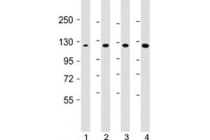 Western blot testing of 1) human DU-145, 2) human HepG2, 3) mouse brain and 4) HeLa cell lysate with AIP1 antibody at 1:1000. (DAB2IP antibody  (AA 782-1038))