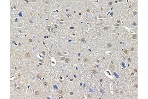 ABIN7096007 and ABIN7100069 at 1/100 staining rat brain tissue by IHC-P.