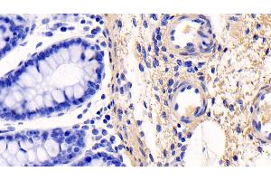 Detection of COL1a1 in Human Colon Tissue using Monoclonal Antibody to Collagen Type I Alpha 1 (COL1a1) (COL1A1 antibody  (AA 253-471))