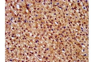 IHC image of ABIN7146392 diluted at 1:400 and staining in paraffin-embedded human adrenal gland tissue performed on a Leica BondTM system. (PNPLA8 antibody  (AA 158-345))