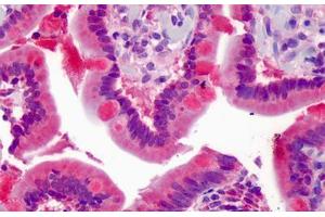 Human Small Intestine: Formalin-Fixed, Paraffin-Embedded (FFPE) (ZNF777 antibody  (AA 468-517))
