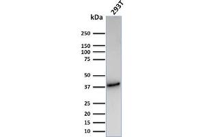 Western Blot Analysis of Human 293T cell lysate using CD74 Recombinant Rabbit Monoclonal Antibody (CLIP/3127R).