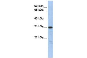 WB Suggested Anti-HOXD9 Antibody Titration:  0. (HOXD9 antibody  (Middle Region))