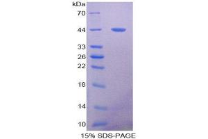SDS-PAGE (SDS) image for Mucin 5 Subtype B (MUC5B) (AA 898-1002) protein (His tag,GST tag) (ABIN2123318)