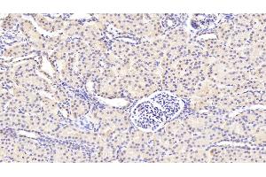 Detection of GUCY1b3 in Human Kidney Tissue using Polyclonal Antibody to Guanylate Cyclase 1 Beta 3 (GUCY1b3) (GUCY1B3 antibody  (AA 408-619))