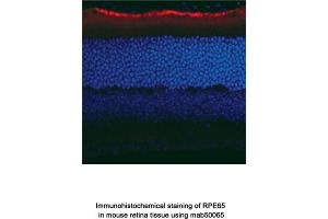 Image no. 2 for anti-Retinal Pigment Epithelium-Specific Protein 65kDa (RPE65) antibody (ABIN363219) (RPE65 antibody)