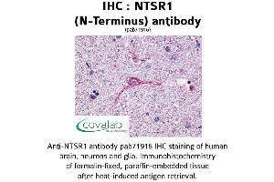 Image no. 1 for anti-Neurotensin Receptor 1 (High Affinity) (NTSR1) (Extracellular Domain), (N-Term) antibody (ABIN1737567)