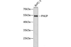 Western blot analysis of extracts of BxPC-3 cells using PNLIP Polyclonal Antibody at dilution of 1:1000. (PNLIP antibody)