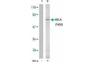Western blot analysis of extracts from COS7 cells using RELA (phospho T435) polyclonal antibody . (NF-kB p65 antibody  (pThr435))