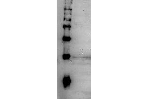 Western Blotting (WB) image for anti-CD248 Molecule, Endosialin (CD248) (full length) antibody (ABIN2452152) (CD248 antibody  (full length))