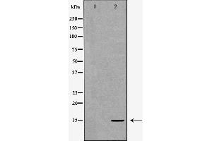 Western blot analysis of extracts of HeLa  using H3K27me1 antibody. (Histone 3 antibody  (H3K27me))