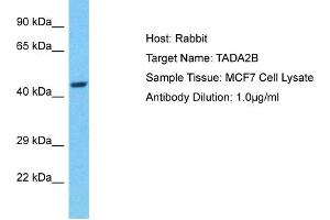 Host: Rabbit Target Name: TADA2B Sample Type: MCF7 Whole Cell lysates Antibody Dilution: 1. (TADA2B antibody  (C-Term))