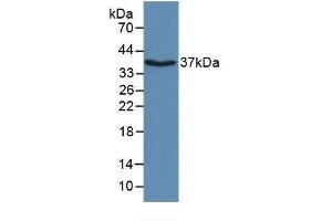 Detection of Recombinant APOH, Bovine using Monoclonal Antibody to Apolipoprotein H (APOH) (APOH antibody  (AA 21-345))