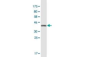 Western Blot detection against Immunogen (37. (HDHD1 antibody  (AA 107-212))