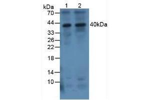 Western blot analysis of (1) Human 293T Cells and (2) Human Jurkat Cells. (IL-1 beta antibody  (AA 117-268))