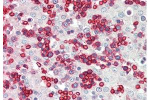 Rabbit Anti-ERMAP antibody  Formalin Fixed Paraffin Embedded Tissue: Human Fetal Liver Primary antibody Concentration: 1:100 Secondary Antibody: Donkey anti-Rabbit-Cy3 Secondary Antibody Concentration: 1:200 Magnification: 20x Exposure Time: 0. (ERMAP antibody  (Middle Region))