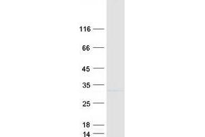 Ras Suppressor Protein 1 (RSU1) (Transcript Variant 2) protein (Myc-DYKDDDDK Tag)