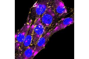 Expression of GFAP in rat C6 glioma cellsFixed and permeabilized cells were stained with Anti-GFAP-ATTO Fluor-647N Antibody (ABIN7582030), (1:200) and with CellMask Orange Actin tracking dye (yellow). (GFAP antibody  (Intracellular) (Atto 647N))