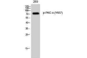 Western Blotting (WB) image for anti-Protein Kinase C, alpha (PKCa) (pTyr657) antibody (ABIN3179536) (PKC alpha antibody  (pTyr657))