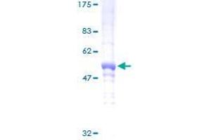 DDAH2 Protein (AA 1-285) (GST tag)