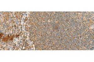 Immunohistochemistry of paraffin-embedded Human tonsil tissue using CD48 Polyclonal Antibody at dilution of 1:95(x200) (CD48 antibody)