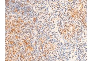 Immunohistochemistry (IHC) image for anti-Forkhead Box O3 (FOXO3) (pSer253) antibody (ABIN6255131)