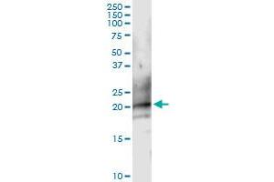 Immunoprecipitation of CD160 transfected lysate using anti-CD160 MaxPab rabbit polyclonal antibody and Protein A Magnetic Bead , and immunoblotted with CD160 purified MaxPab mouse polyclonal antibody (B01P) . (CD160 antibody  (AA 1-181))