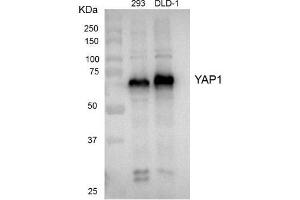 Western blot analysis of extracts from HEK 293 cells and DLD-1 cells using YAP1 antibody (1:1000).