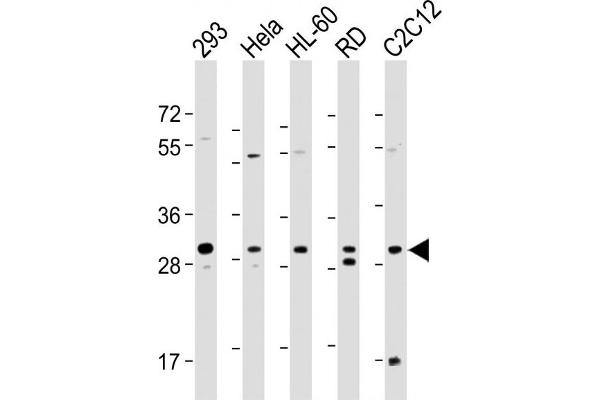 EIF4E2 antibody