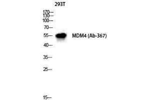 Western Blotting (WB) image for anti-Mdm4-binding Protein (MDM4) (Ser885) antibody (ABIN3175952) (MDM4-binding Protein antibody  (Ser885))