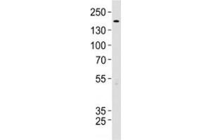 TSC2 antibody western blot analysis in 293 lysate. (Tuberin antibody  (AA 1397-1426))