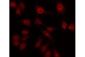 ABIN6276038 staining LOVO by IF/ICC. (GPR75 antibody  (Internal Region))