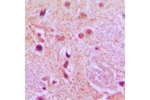 Immunohistochemical analysis of AGFG1 staining in human brain formalin fixed paraffin embedded tissue section. (AGFG1 antibody)