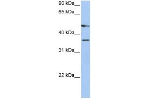 WB Suggested Anti-FOXD4 Antibody Titration:  0. (FOXD4 antibody  (C-Term))
