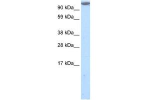 Western Blot showing MKL1 antibody used at a concentration of 1-2 ug/ml to detect its target protein.