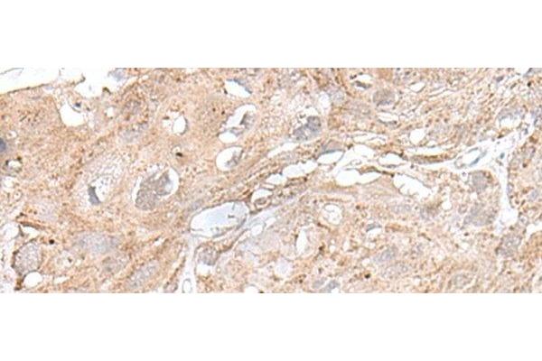 SNRNP25 antibody