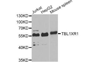 Western blot analysis of extracts of various cell lines, using TBL1XR1 Antibody (ABIN5975754) at 1/1000 dilution. (TBL1XR1 antibody)