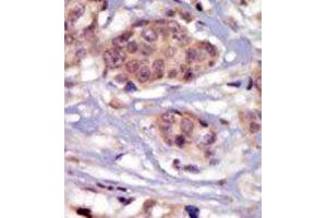 Image no. 1 for anti-FYN Oncogene Related To SRC, FGR, YES (FYN) (N-Term) antibody (ABIN359983) (FYN antibody  (N-Term))