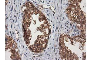 Image no. 7 for anti-Destrin (Actin Depolymerizing Factor) (DSTN) antibody (ABIN1497910) (Destrin antibody)