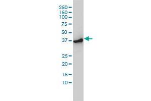 Western Blotting (WB) image for anti-Actin-Related Protein 2 (ACTR2) (AA 1-395) antibody (ABIN599116) (ACTR2 antibody  (AA 1-395))