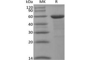 Western Blotting (WB) image for Bromodomain Containing 4 (BRD4) protein (ABIN7319875) (BRD4 Protein)