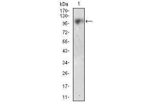 Western blot analysis using CD10 mouse mAb against LNCAP cell lysate. (MME antibody  (AA 52-246))