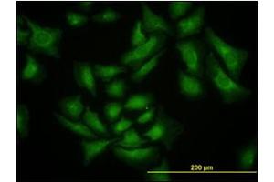 Immunofluorescence (IF) image for anti-SMAD Specific E3 Ubiquitin Protein Ligase 1 (SMURF1) antibody (ABIN781919) (SMURF1 antibody)
