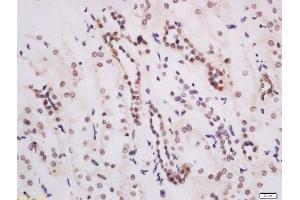 Formalin-fixed and paraffin embedded human kidney labeled with Anti-DOT1L Polyclonal Antibody, Unconjugated  at 1:200 followed by conjugation to the secondary antibody and DAB staining. (DOT1L antibody  (AA 51-150))