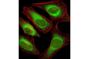 Fluorescent image of Hela cells stained with USP51 Antibody (Center) C. (USP51 antibody  (AA 278-307))