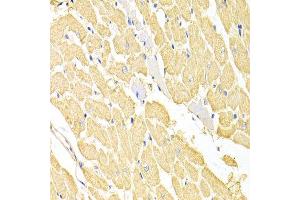 Immunohistochemistry of paraffin-embedded rat heart using RRM2 antibody at dilution of 1:100 (x400 lens). (RRM2 antibody)