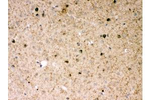 Immunohistochemistry (IHC) image for anti-Parkinson Protein 2, E3 Ubiquitin Protein Ligase (Parkin) (PARK2) (AA 23-416) antibody (ABIN3043896)