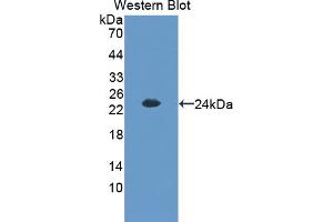 Western blot analysis of the recombinant protein. (CITED1 antibody  (C-Term))
