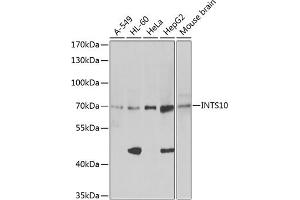 Western blot analysis of extracts of HeLa cells, using INTS10 antibody (ABIN6129778, ABIN6142484, ABIN6142486 and ABIN6217410) at 1:1046 dilution. (INTS10 antibody  (AA 451-710))