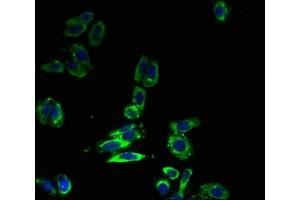 Immunofluorescent analysis of HepG2 cells using ABIN7176680 at dilution of 1:100 and Alexa Fluor 488-congugated AffiniPure Goat Anti-Rabbit IgG(H+L)